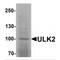 Unc-51 Like Autophagy Activating Kinase 2 antibody, MBS153350, MyBioSource, Western Blot image 