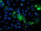 Phosphoglycerate Mutase 2 antibody, TA503424, Origene, Immunofluorescence image 