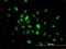 SWI/SNF-related matrix-associated actin-dependent regulator of chromatin subfamily E member 1-related antibody, H00010362-M01, Novus Biologicals, Immunofluorescence image 