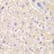 Chloride intracellular channel protein 5 antibody, orb324599, Biorbyt, Immunohistochemistry paraffin image 