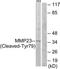 Matrix Metallopeptidase 23B antibody, TA314760, Origene, Western Blot image 