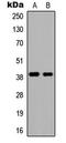 DMRT Like Family C2 antibody, LS-C354344, Lifespan Biosciences, Western Blot image 