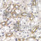 CD38 Molecule antibody, A1680, ABclonal Technology, Immunohistochemistry paraffin image 