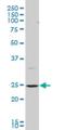 BCAP29, CT antibody, H00055973-M07, Novus Biologicals, Western Blot image 