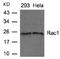 Rac Family Small GTPase 1 antibody, AP02713PU-N, Origene, Western Blot image 