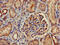 Protein Kinase D3 antibody, CSB-PA018713LA01HU, Cusabio, Immunohistochemistry paraffin image 