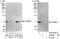 Catenin Beta Like 1 antibody, A302-663A, Bethyl Labs, Immunoprecipitation image 