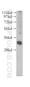 Solute Carrier Family 25 Member 34 antibody, 17557-1-AP, Proteintech Group, Western Blot image 