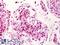 SPT16 Homolog, Facilitates Chromatin Remodeling Subunit antibody, LS-B753, Lifespan Biosciences, Immunohistochemistry paraffin image 