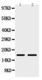 Somatostatin antibody, PA1346, Boster Biological Technology, Western Blot image 