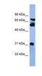 Cytochrome P450 Family 8 Subfamily B Member 1 antibody, NBP1-68884, Novus Biologicals, Western Blot image 