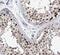 CGRP Receptor Component antibody, FNab01955, FineTest, Immunohistochemistry paraffin image 