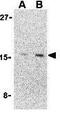 Cerebellin 1 Precursor antibody, GTX85500, GeneTex, Western Blot image 