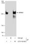 Eukaryotic translation initiation factor 4 gamma 3 antibody, GTX118109, GeneTex, Immunoprecipitation image 