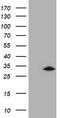 Glutathione S-Transferase Omega 2 antibody, TA504083S, Origene, Western Blot image 