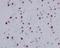 Histone Cluster 1 H2A Family Member E antibody, M16777-3, Boster Biological Technology, Immunohistochemistry paraffin image 