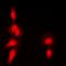 Histone Deacetylase 7 antibody, orb393312, Biorbyt, Immunofluorescence image 