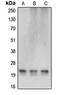 Cerebellin 4 Precursor antibody, orb215375, Biorbyt, Western Blot image 