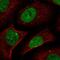 Zinc finger protein 638 antibody, NBP1-82730, Novus Biologicals, Immunofluorescence image 