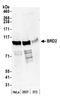 Bromodomain Containing 2 antibody, A302-583A, Bethyl Labs, Western Blot image 