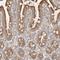 Chromosome 12 Open Reading Frame 49 antibody, HPA026905, Atlas Antibodies, Immunohistochemistry paraffin image 