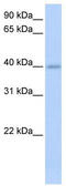 Izumo Sperm-Egg Fusion 1 antibody, TA339199, Origene, Western Blot image 