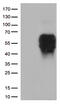 B And T Lymphocyte Associated antibody, CF812582, Origene, Western Blot image 