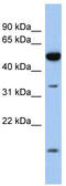 Retinol Dehydrogenase 12 antibody, TA338851, Origene, Western Blot image 