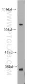 Sodium/myo-inositol cotransporter antibody, 21628-1-AP, Proteintech Group, Western Blot image 
