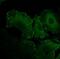 Vinculin antibody, NB600-1293, Novus Biologicals, Immunocytochemistry image 