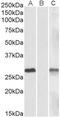 DPY30 Domain Containing 1 antibody, NBP1-47218, Novus Biologicals, Western Blot image 