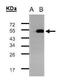 Transcriptional Adaptor 3 antibody, GTX101991, GeneTex, Western Blot image 