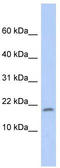 Ribosomal Protein S15 antibody, TA336067, Origene, Western Blot image 