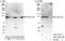 VPS50 Subunit Of EARP/GARPII Complex antibody, A303-323A, Bethyl Labs, Western Blot image 