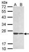 Membrane Anchored Junction Protein antibody, TA309063, Origene, Western Blot image 