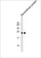 Histone-lysine N-methyltransferase MLL3 antibody, MA5-24750, Invitrogen Antibodies, Western Blot image 