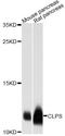 Colipase antibody, A12772, ABclonal Technology, Western Blot image 