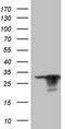 Potassium Voltage-Gated Channel Interacting Protein 2 antibody, TA807451, Origene, Western Blot image 