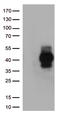 T Cell Immunoreceptor With Ig And ITIM Domains antibody, TA813029, Origene, Western Blot image 