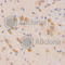 3-Phosphoinositide Dependent Protein Kinase 1 antibody, A1665, ABclonal Technology, Immunohistochemistry paraffin image 