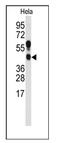 Protein arginine N-methyltransferase 1 antibody, AP11003PU-N, Origene, Western Blot image 