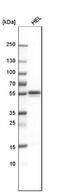 LYN Proto-Oncogene, Src Family Tyrosine Kinase antibody, NBP1-83072, Novus Biologicals, Western Blot image 