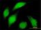 BUB1 Mitotic Checkpoint Serine/Threonine Kinase antibody, H00000699-M01, Novus Biologicals, Immunofluorescence image 