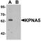 Karyopherin Subunit Alpha 5 antibody, PA5-72750, Invitrogen Antibodies, Western Blot image 