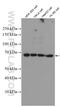 Protein Arginine Methyltransferase 5 antibody, 27109-1-AP, Proteintech Group, Western Blot image 