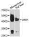 Dickkopf WNT Signaling Pathway Inhibitor 1 antibody, STJ23386, St John