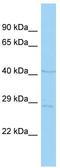 Peptidoglycan Recognition Protein 4 antibody, TA333739, Origene, Western Blot image 