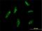 BMP-2-inducible protein kinase antibody, H00055589-M03, Novus Biologicals, Immunocytochemistry image 