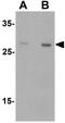 C-Type Lectin Domain Containing 7A antibody, GTX31853, GeneTex, Western Blot image 