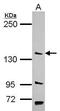 Poly(A) Specific Ribonuclease Subunit PAN2 antibody, PA5-31079, Invitrogen Antibodies, Western Blot image 